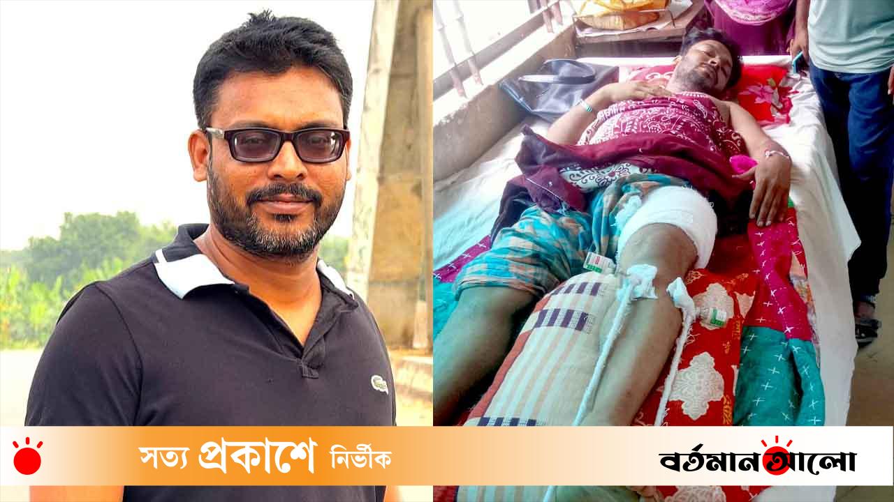 মর্মান্তিক দুর্ঘটনায় গুরুতর আহত যাযাবর পলাশ; চিকিৎসার জন্য দোয়া ও সহযোগিতা কামনা